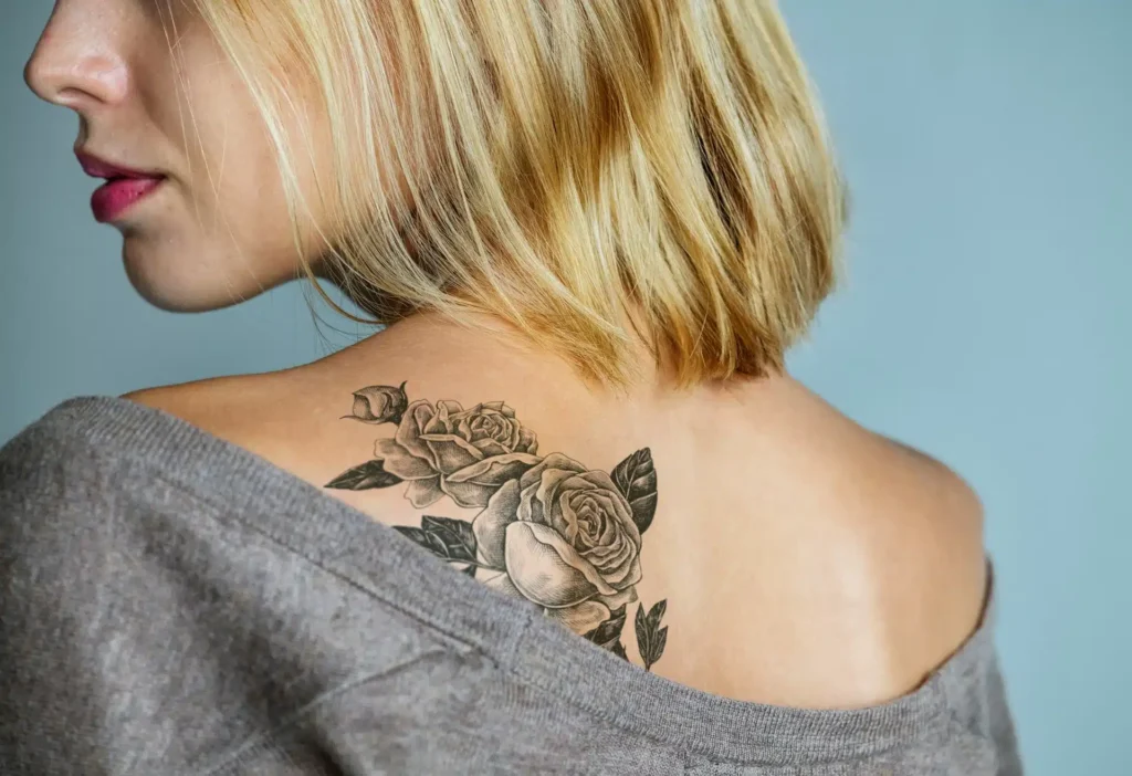 Tattoo removal